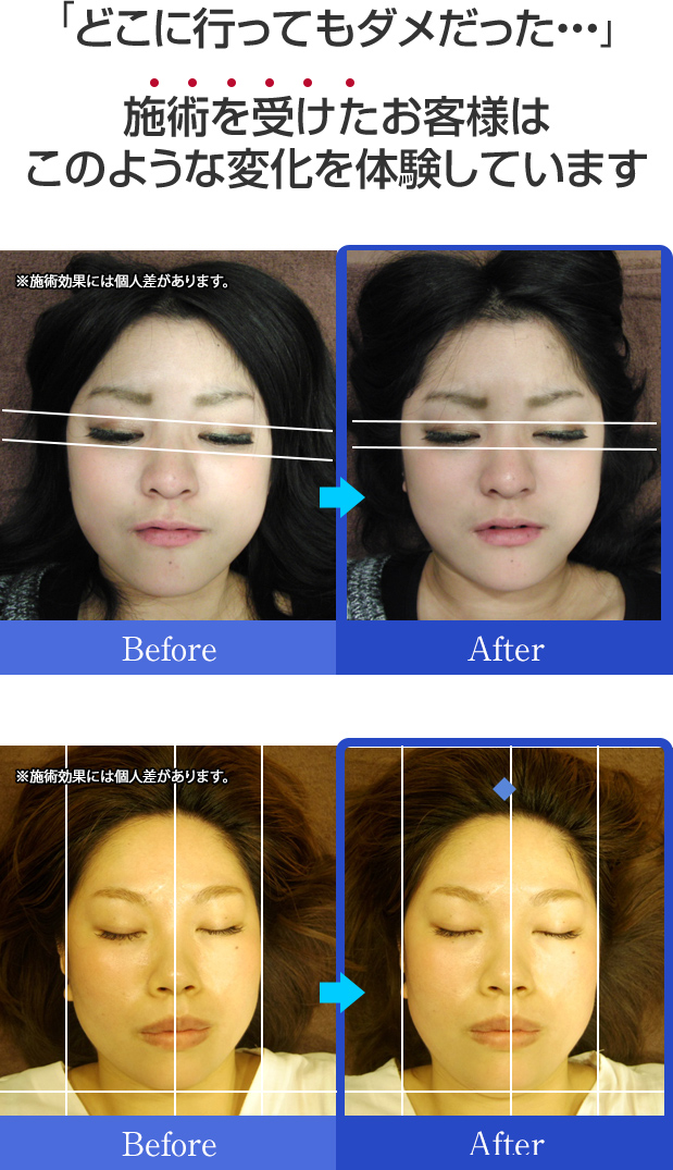 「どこに行ってもダメだった・・・」たった1回で驚きの施術効果をご確認ください